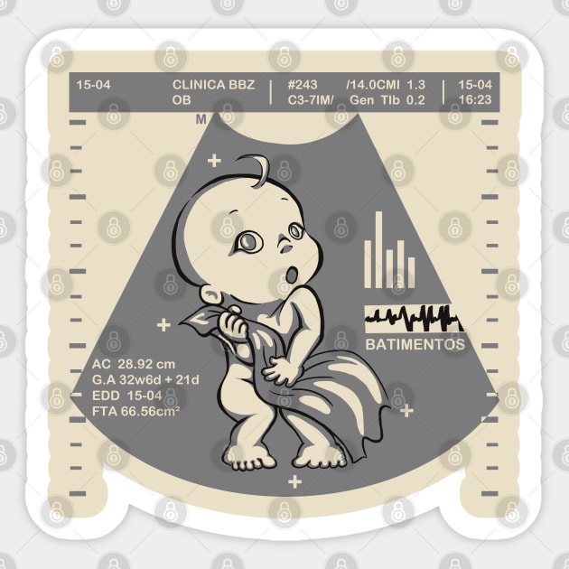 Ultrasound timid baby Sticker by Lima's